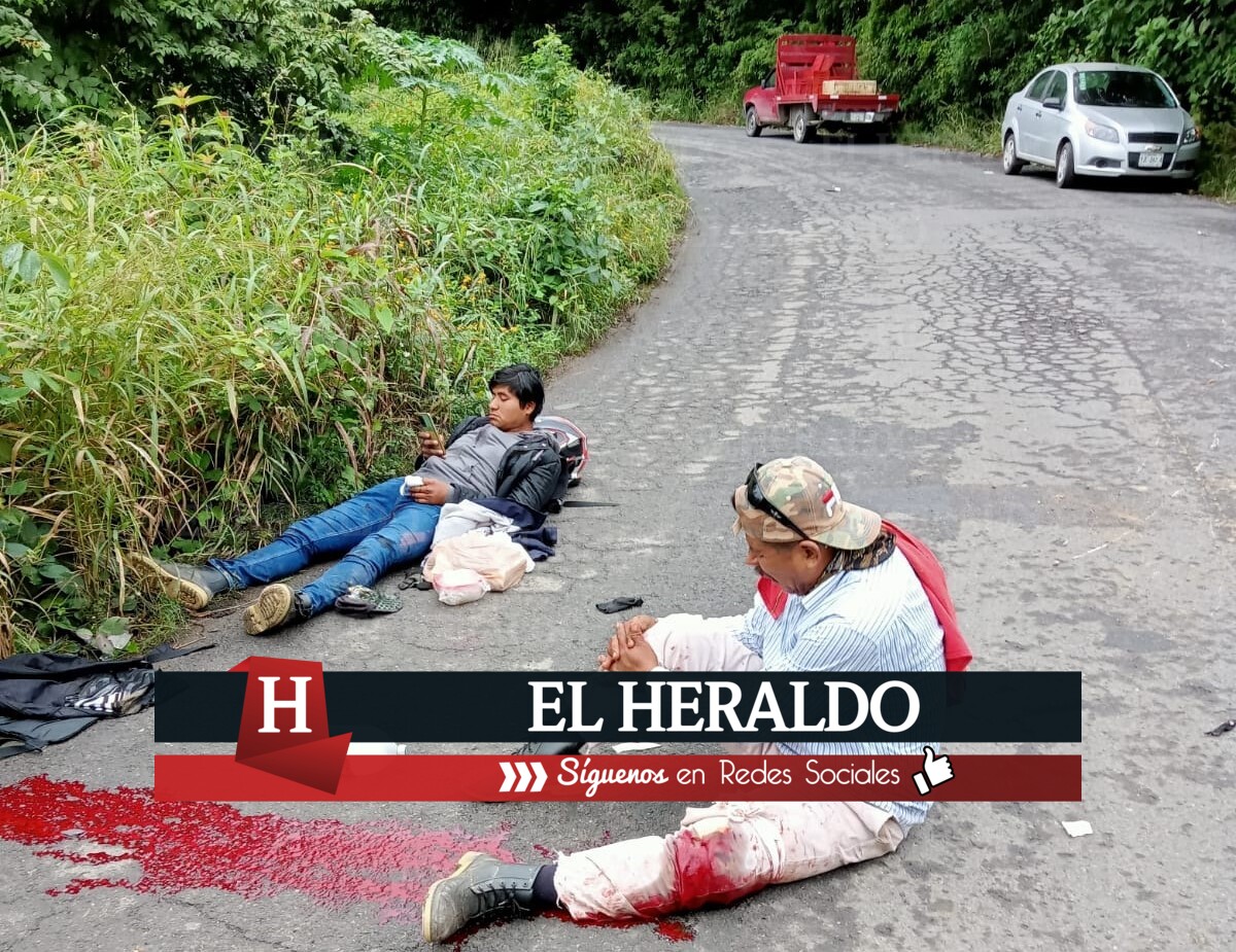 Padre e hijo se accidentan 2